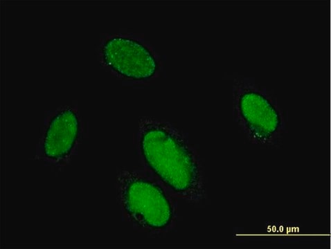 Monoclonal Anti-PITX2 antibody produced in mouse clone 2G6, purified immunoglobulin, buffered aqueous solution