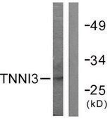Anti-TNNI3 antibody produced in rabbit affinity isolated antibody