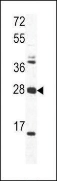 ANTI-OAZ1(N-TERMINAL) antibody produced in rabbit purified immunoglobulin, buffered aqueous solution