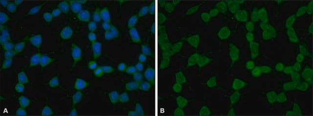 Anti-phospho-YAP1 (pTyr357) antibody produced in rabbit ~1.5&#160;mg/mL, affinity isolated antibody, buffered aqueous solution