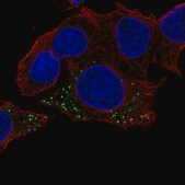Anti-HBB antibody produced in rabbit Prestige Antibodies&#174; Powered by Atlas Antibodies, affinity isolated antibody, buffered aqueous glycerol solution
