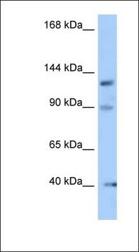 Anti-OFD1 antibody produced in rabbit affinity isolated antibody