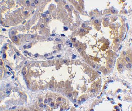 Anti-RAIDD antibody produced in rabbit IgG fraction of antiserum, buffered aqueous solution