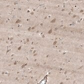 Anti-HMGCR antibody produced in rabbit Prestige Antibodies&#174; Powered by Atlas Antibodies, affinity isolated antibody, buffered aqueous glycerol solution