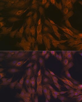 Anti-ULK3 Antibody, clone 5Z7Z6, Rabbit Monoclonal