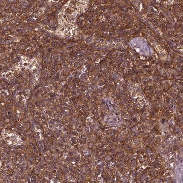 Anti-RASSF5 antibody produced in rabbit Prestige Antibodies&#174; Powered by Atlas Antibodies, affinity isolated antibody