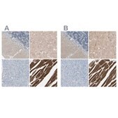 Anti-CACNA2D1 antibody produced in rabbit Prestige Antibodies&#174; Powered by Atlas Antibodies, affinity isolated antibody, buffered aqueous glycerol solution