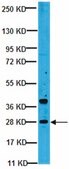 Anti-PDGF-BB Antibody from rabbit, purified by affinity chromatography