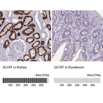 Anti-GLYAT antibody produced in rabbit Prestige Antibodies&#174; Powered by Atlas Antibodies, affinity isolated antibody