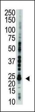 ANTI-E2EPF(C-TERMINAL) antibody produced in rabbit IgG fraction of antiserum, buffered aqueous solution