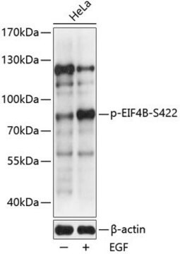 Anti-Phospho-EIF4B-S422 antibody produced in rabbit