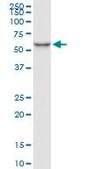 Monoclonal Anti-SERPINC1 antibody produced in mouse clone 2B12, ascites fluid