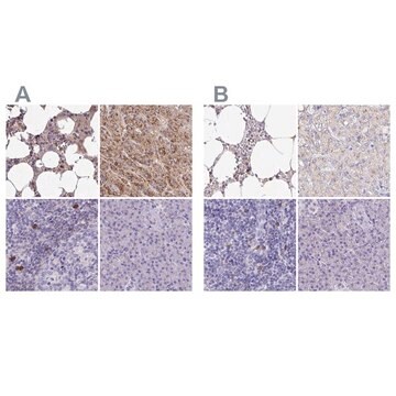 Anti-CAT antibody produced in rabbit Prestige Antibodies&#174; Powered by Atlas Antibodies, affinity isolated antibody, buffered aqueous glycerol solution