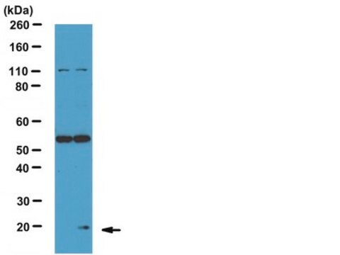 Anti-Phospho- Bad (Ser75) Antibody from rabbit