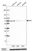 Anti-ESR1 antibody produced in rabbit Prestige Antibodies&#174; Powered by Atlas Antibodies, affinity isolated antibody, buffered aqueous glycerol solution