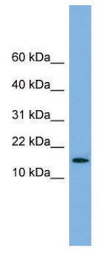 Anti-SPA17 (N-terminal) antibody produced in rabbit affinity isolated antibody