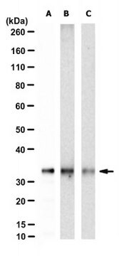 Anti-ANT1/SLC25A4 Antibody, clone IF3F11