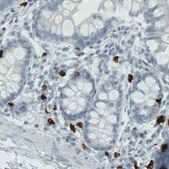 Monoclonal Anti-MMP9 antibody produced in mouse Prestige Antibodies&#174; Powered by Atlas Antibodies, clone CL0538, purified immunoglobulin, buffered aqueous glycerol solution