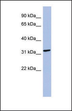 Anti-MAGEB2, (N-terminal) antibody produced in rabbit affinity isolated antibody