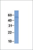 Anti-ABAT antibody produced in rabbit affinity isolated antibody