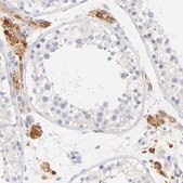 Anti-EBP antibody produced in rabbit Prestige Antibodies&#174; Powered by Atlas Antibodies, affinity isolated antibody, buffered aqueous glycerol solution