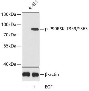 Anti-Phospho-P90RSK-T359/S363 antibody produced in rabbit