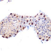 Anti-LXR&#945; antibody produced in rabbit
