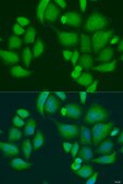Anti-CAPN2 antibody produced in rabbit