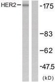 Anti-HER2 antibody produced in rabbit affinity isolated antibody