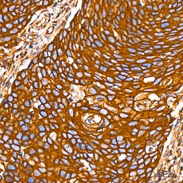 Anti-Filamin A Antibody, clone 3X8Y9, Rabbit Monoclonal