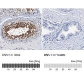 Anti-DNAI1 antibody produced in rabbit Prestige Antibodies&#174; Powered by Atlas Antibodies, affinity isolated antibody, buffered aqueous glycerol solution, Ab1