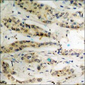 Anti-phospho-p53 (pThr18) antibody produced in rabbit affinity isolated antibody