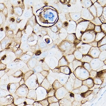 Anti-MUC1 antibody produced in rabbit