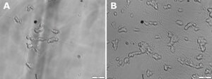 BDNF human Carrier free, recombinant, expressed in E. coli, &#8805;95% (SDS-PAGE), suitable for cell culture