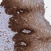 Anti-GCLC antibody produced in rabbit Prestige Antibodies&#174; Powered by Atlas Antibodies, affinity isolated antibody, buffered aqueous glycerol solution