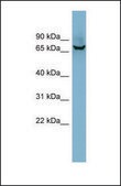 Anti-ACHE, (N-terminal) antibody produced in rabbit affinity isolated antibody