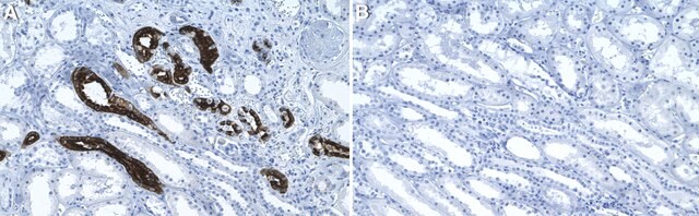 Anti-Aquaporin-2 Antibody, clone 1C22 ZooMAb&#174; Rabbit Monoclonal recombinant, expressed in HEK 293 cells