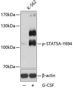 Anti-Phospho-STAT5A-Y694 antibody produced in rabbit