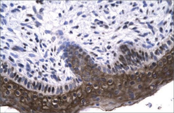 Anti-RAX (AB2) antibody produced in rabbit affinity isolated antibody