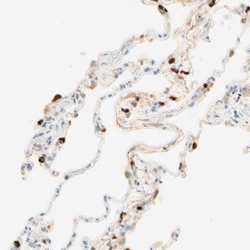 Anti-CD63 antibody produced in rabbit affinity isolated antibody, Prestige Antibodies&#174; Powered by Atlas Antibodies, buffered aqueous glycerol solution