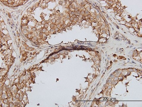 Monoclonal Anti-PIP5K3 antibody produced in mouse clone 6C7, purified immunoglobulin, buffered aqueous solution