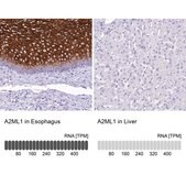 Anti-A2ML1 antibody produced in rabbit Prestige Antibodies&#174; Powered by Atlas Antibodies, affinity isolated antibody, buffered aqueous glycerol solution
