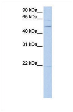 Anti-RORB antibody produced in rabbit affinity isolated antibody