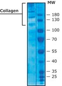 Collagen from human placenta Bornstein and Traub Type IV, powder, BioReagent, suitable for cell culture