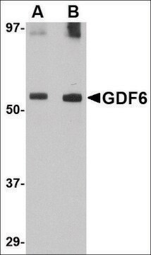 Anti-GDF6 antibody produced in rabbit affinity isolated antibody, buffered aqueous solution