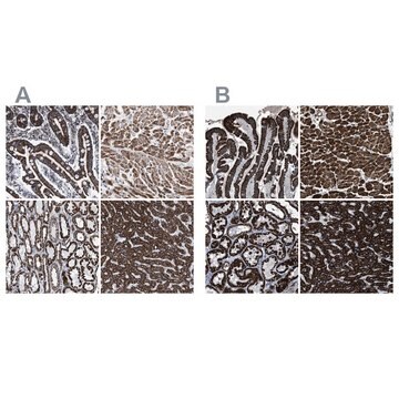 Anti-ECHS1 antibody produced in rabbit Prestige Antibodies&#174; Powered by Atlas Antibodies, affinity isolated antibody, buffered aqueous glycerol solution, Ab1