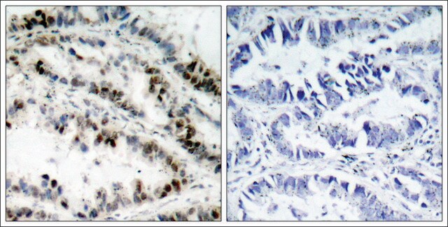 Anti-phospho-SMC1A (pSer957) antibody produced in rabbit affinity isolated antibody