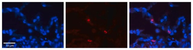 Anti-FCGRT affinity isolated antibody