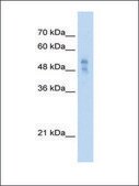 Anti-P2RX1 antibody produced in rabbit IgG fraction of antiserum