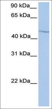 Anti-HOXA13 antibody produced in rabbit affinity isolated antibody